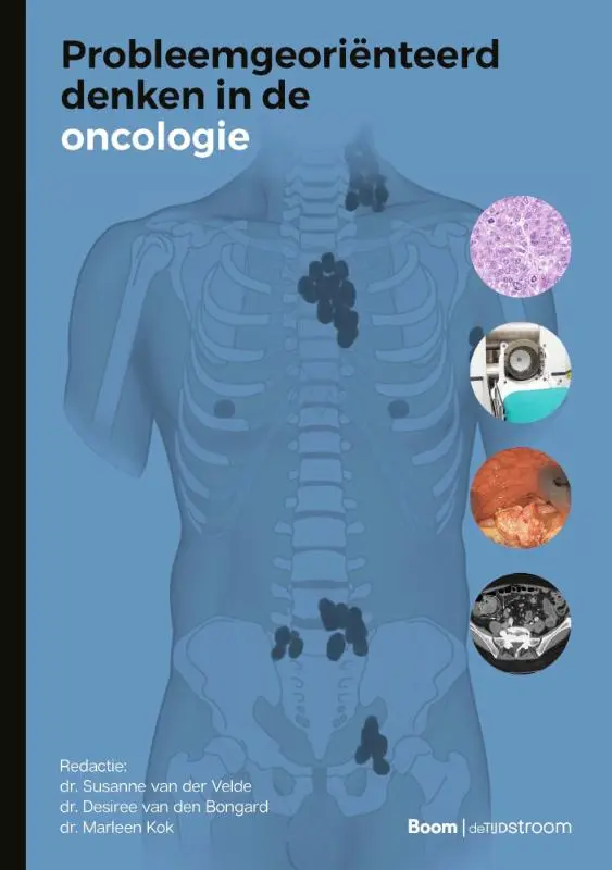 Probleemgeoriënteerd denken in de oncologie